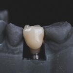 Dentální hygiena Praha – profesionální čištění zubů