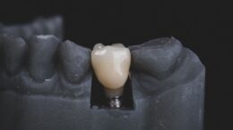dentalni hygiena