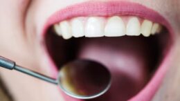 Zubar Praha 2 moderni pece o vas usmev v centru mesta